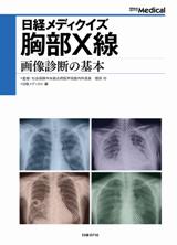 日経メディクイズ 胸部X線 画像診断の基本