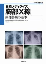 日経メディクイズ　胸部X線　画像診断の基本