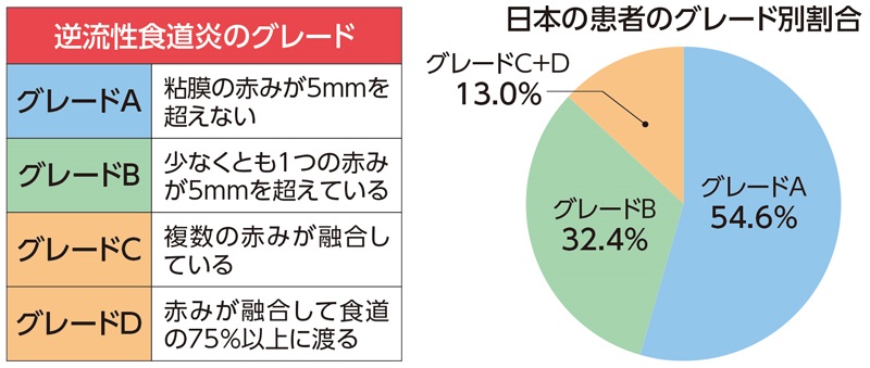 逆流性食道炎のグレード