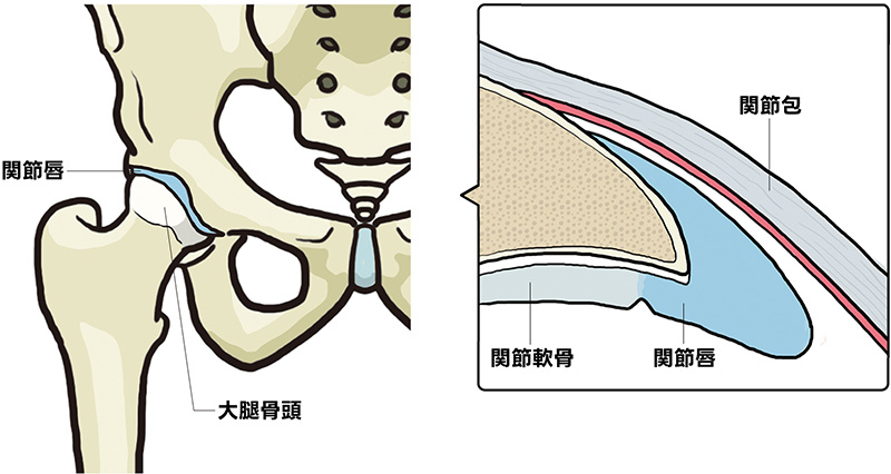 関節唇
