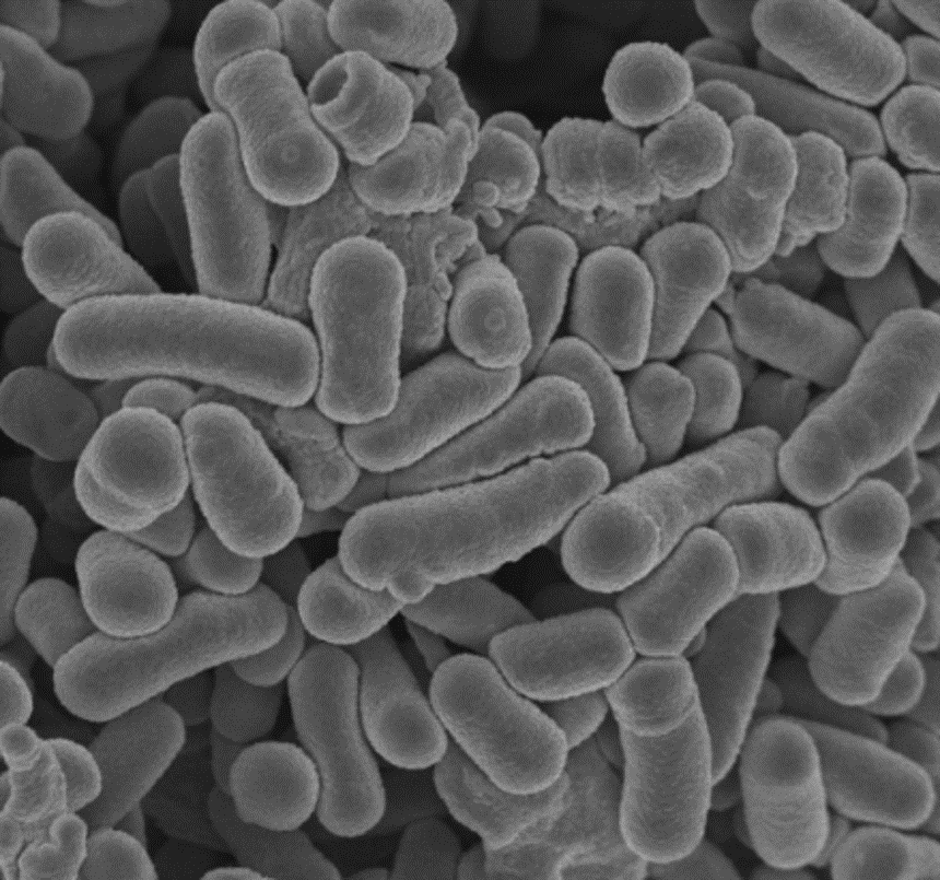 発見されたブラウティア菌（写真提供／国立研究開発法人 医薬基盤・健康・栄養研究所）