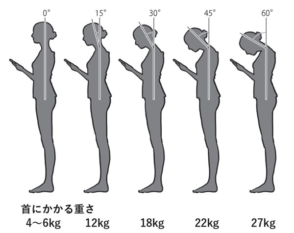 スマートフォンをのぞき込むようにして使っていると、首には大きな負荷がかかる（『すごい頸椎』より。イラスト＝内山弘隆）