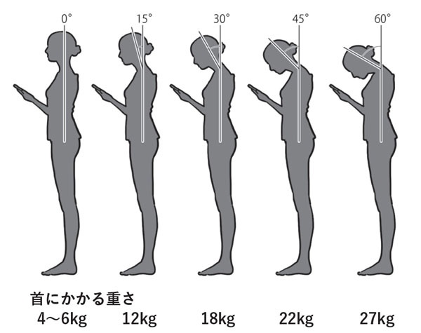 スマートフォンをのぞき込むようにして使っていると、首には大きな負荷がかかる(『すごい頸椎』より。イラスト=内山弘隆)