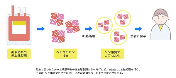 人工赤血球製剤の調達プロセス (出所:日経メディカル)